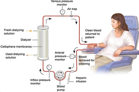 The Dialysis Co .